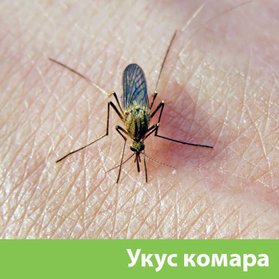 Укусы комаров в Вельске