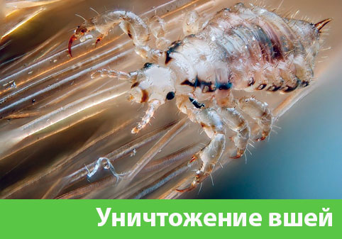 Уничтожение вшей в городе Вельск